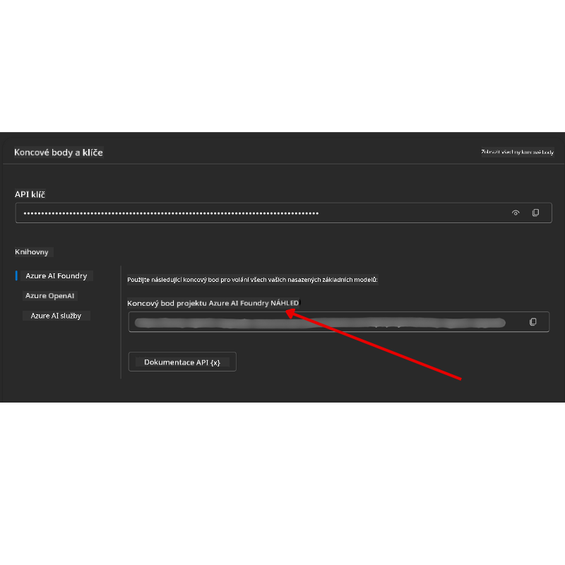 Project Connection String